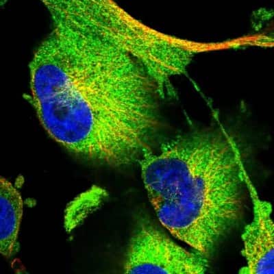 Immunocytochemistry/ Immunofluorescence: iASPP Antibody [NBP2-48732]