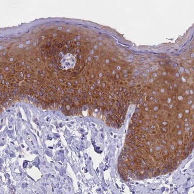 Immunohistochemistry-Paraffin: iASPP Antibody [NBP2-48732]