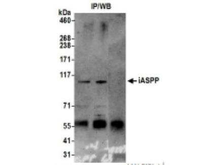 Immunoprecipitation: iASPP Antibody [NB100-88155]