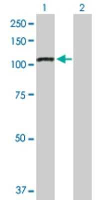 Western Blot: iASPP Antibody [H00010848-D01P]
