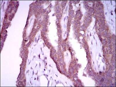 Immunohistochemistry: iNOS Antibody (4E5) - Azide and BSA Free [NBP2-80814]