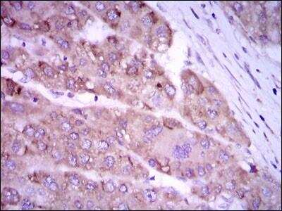 Immunohistochemistry-Paraffin: iNOS Antibody (4E5) - BSA Free [NBP2-22119]