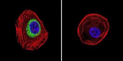 Immunocytochemistry/ Immunofluorescence: iNOS Antibody - BSA Free [NB300-605]