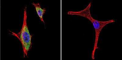 Immunocytochemistry/ Immunofluorescence: iNOS Antibody - BSA Free [NB300-605]