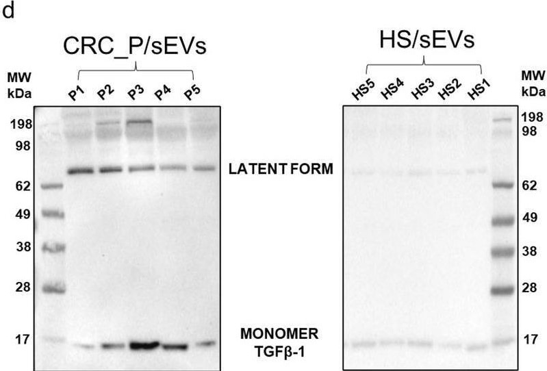 Detection of TGF-beta 1 by Western Blot