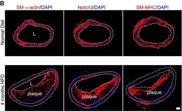 Detection of Mouse alpha-Smooth Muscle Actin by Immunohistochemistry