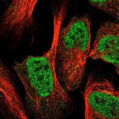 Immunocytochemistry/ Immunofluorescence: integrin beta 4 binding protein Antibody [NBP2-13954]