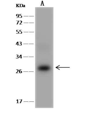 Western Blot: integrin beta 4 binding protein Antibody [NBP3-06333]