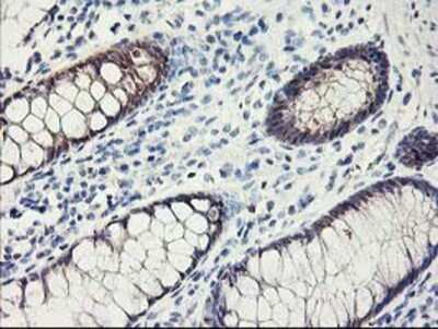 Immunohistochemistry-Paraffin: FABP2/I-FABP Antibody (OTI2C4) [NBP2-01239]