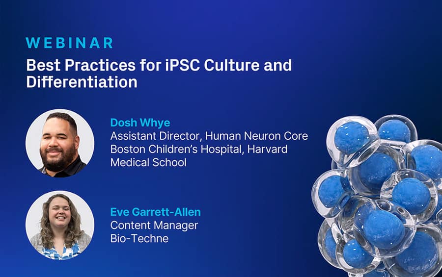 Webinar: Best Practices for iPSC Culture and Differentiation