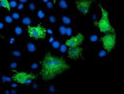 Immunocytochemistry/ Immunofluorescence: katanin-p80 Antibody (OTI5C4) [NBP2-01383]