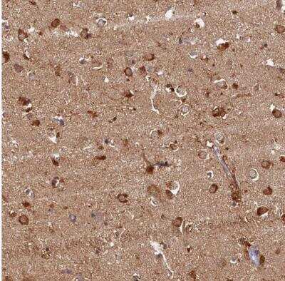 Immunohistochemistry-Paraffin: katanin-p80 Antibody [NBP1-87503]