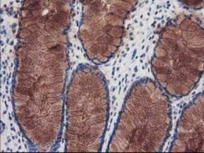 Immunohistochemistry: katanin-p80 Antibody (OTI5C4) - Azide and BSA Free [NBP2-71578]
