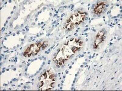 Immunohistochemistry: katanin-p80 Antibody (OTI5C4) - Azide and BSA Free [NBP2-71578]