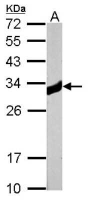 Western Blot: Ketohexokinase Antibody [NBP1-32778]