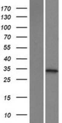 Western Blot: Ketohexokinase Overexpression Lysate [NBP2-10410]
