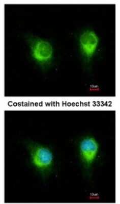 Immunocytochemistry/ Immunofluorescence: kinectin Antibody [NBP2-15003]