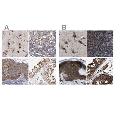 Immunohistochemistry-Paraffin: kinectin Antibody [NBP1-90634]