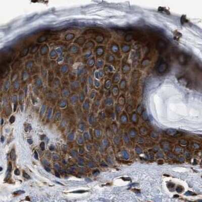Immunohistochemistry-Paraffin: kinectin Antibody [NBP1-90635]