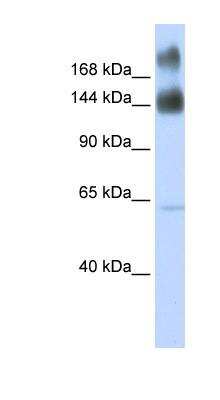 Western Blot: kinectin Antibody [NBP1-91592]