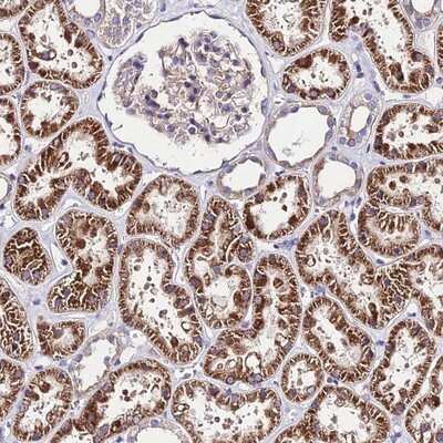 Immunohistochemistry-Paraffin: lactamase, beta 2 Antibody [NBP1-92064]