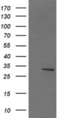 Western Blot: lactamase, beta 2 Antibody (OTI4F7) [NBP2-45580]