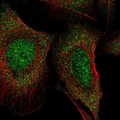 Immunocytochemistry/ Immunofluorescence: lactamase, beta 2 Antibody [NBP2-55664]