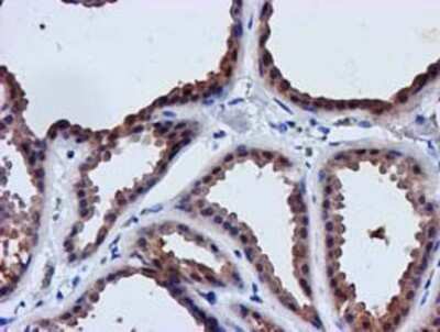 Immunohistochemistry: lactamase, beta 2 Antibody (OTI2F9) - Azide and BSA Free [NBP2-71901]