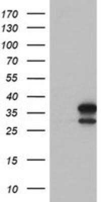 Western Blot: lactamase, beta 2 Antibody (OTI2F9)Azide and BSA Free [NBP2-71901]