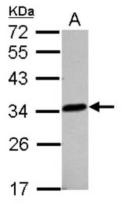 Western Blot: lactamase, beta 2 Antibody [NBP2-19319]