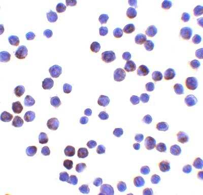 Immunocytochemistry/ Immunofluorescence: lin-54 Antibody - BSA Free [NBP2-82002]