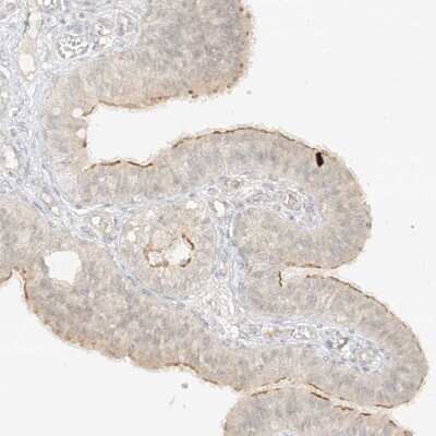 Immunohistochemistry-Paraffin: lipoyltransferase 1 Antibody [NBP1-92073]