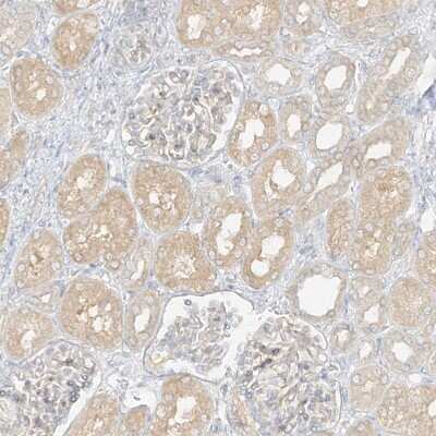 Immunohistochemistry-Paraffin: lipoyltransferase 1 Antibody [NBP1-92073]
