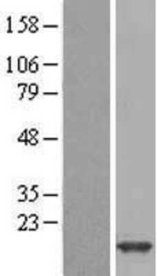Western Blot: FABP1/L-FABP Overexpression Lysate [NBL1-10417]