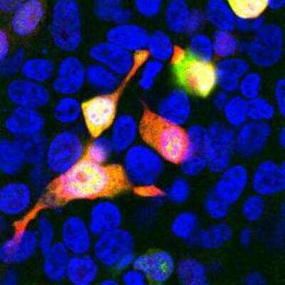 Immunocytochemistry/ Immunofluorescence: mCherry Antibody (1C51) [NBP1-96752]