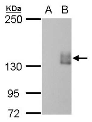 Western Blot: mCherry Antibody (844) [NBP2-43778]