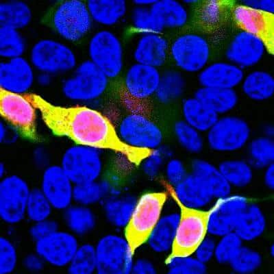 Immunocytochemistry/ Immunofluorescence: mCherry Antibody [NBP2-25157]