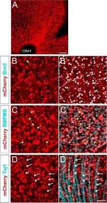 Immunohistochemistry-Paraffin: mCherry Antibody [NBP2-25157]