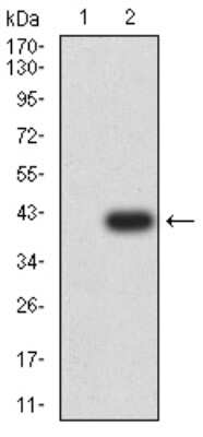 Western Blot: mGluR1 Antibody (5E12D8)BSA Free [NBP2-61827]