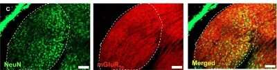Immunohistochemistry: mGluR1 Antibody - BSA Free [NB100-93555]