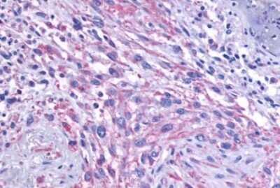 Immunohistochemistry-Paraffin: mGluR1 Antibody - BSA Free [NLS882]