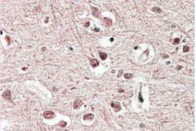 Immunohistochemistry-Paraffin: mGluR2 Antibody [NBP1-68855]