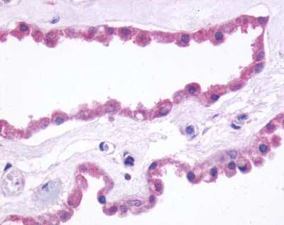 Immunohistochemistry-Paraffin: mGluR3 Antibody - BSA Free [NLS3208]