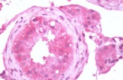 Immunohistochemistry-Paraffin: mGluR3 Antibody - BSA Free [NLS3208]