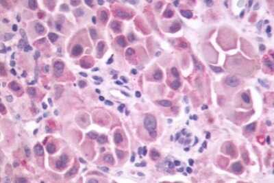 Immunohistochemistry-Paraffin: mGluR3 Antibody - BSA Free [NLS3208]