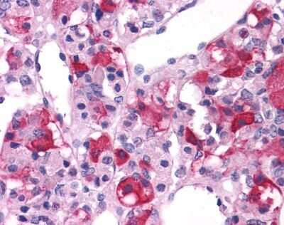 Immunohistochemistry-Paraffin: mGluR3 Antibody - BSA Free [NLS899]