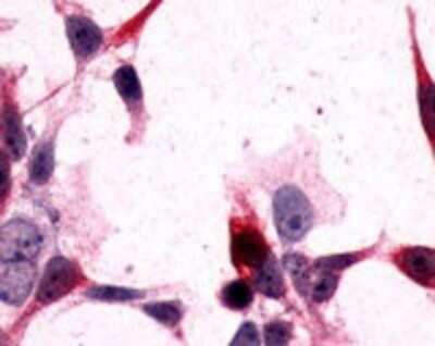 Immunohistochemistry-Paraffin: mGluR3 Antibody - BSA Free [NLS899]