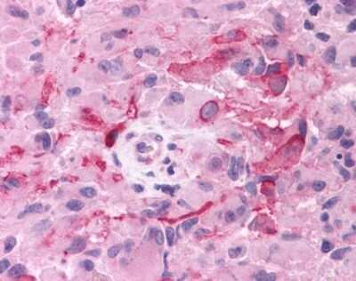 Immunohistochemistry-Paraffin: mGluR3 Antibody - BSA Free [NLS899]