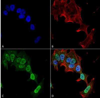 Immunocytochemistry/ Immunofluorescence: mGluR5/1a Antibody (S75-33) [NBP2-59334]