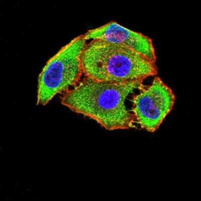 Immunocytochemistry/ Immunofluorescence: mGluR5 Antibody (1A11D10) - BSA Free [NBP2-61828]